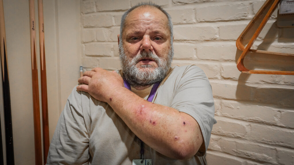 Man shows wounds