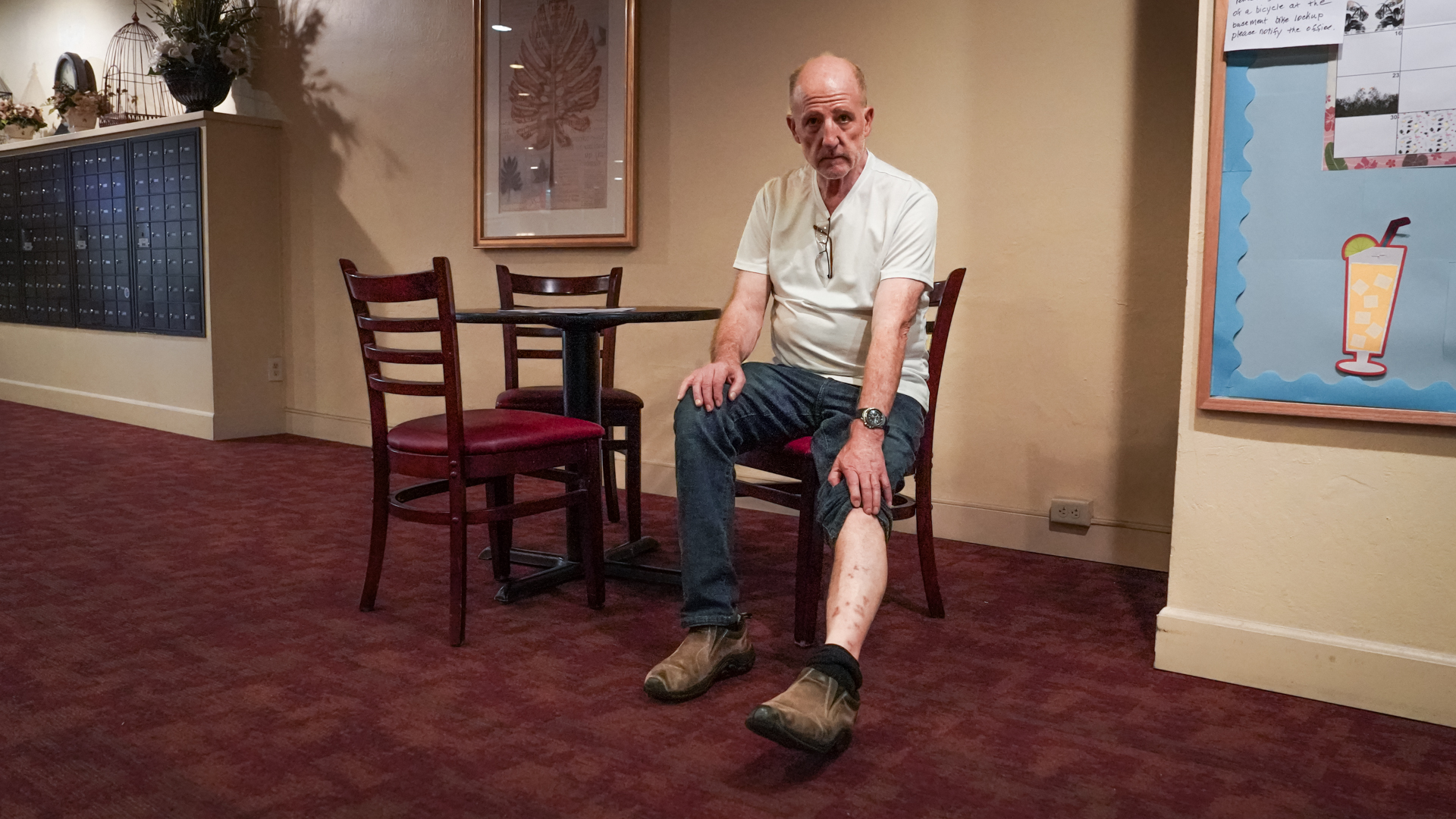 Man shows his leg